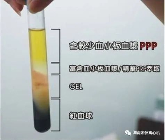 【과학 대중화】 PRP Autologous Serum Beauty
