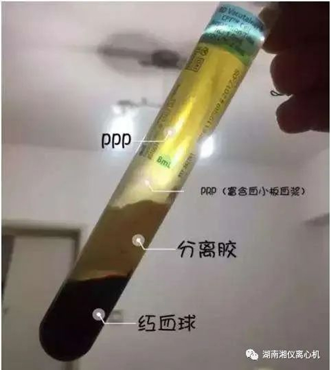 【과학 대중화】 PRP Autologous Serum Beauty